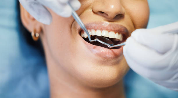 Best Emergency Treatment for Oral Infections in Valdosta, GA