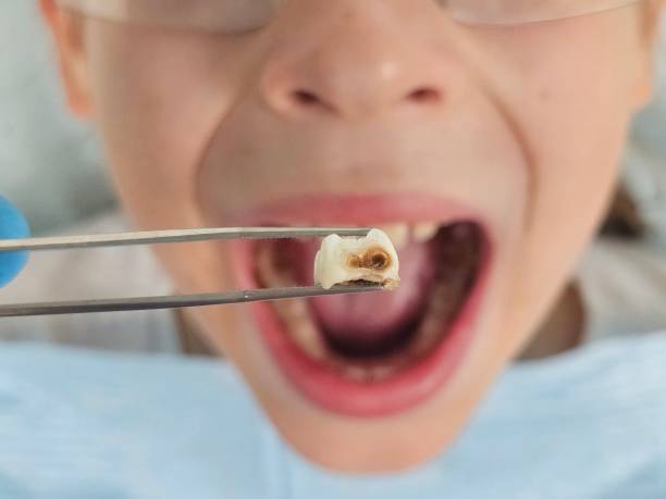 Professional Emergency Dental Service in GA