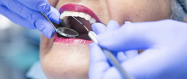 Best Emergency Cosmetic Dentistry (e.g., broken veneers) in Valdosta, GA